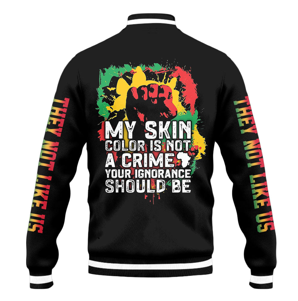"Skin Pride" Baseball Jacket